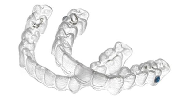 Ansicht 2 - Invisalign Zahnspange